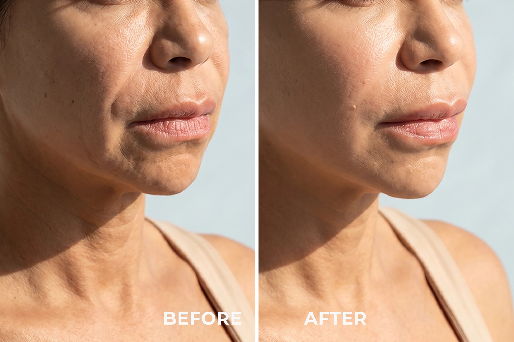 MIRA - Thiết bị chống lão hóa bằng dòng điện vi mô