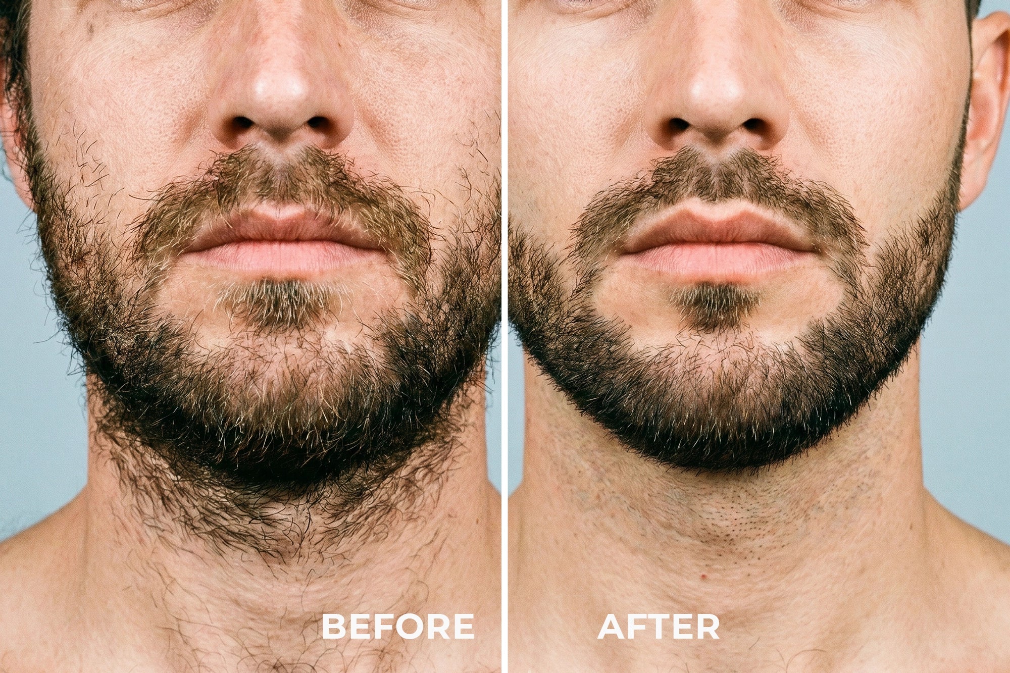 HIGE PRO - UNIVERSAL 6-IN-1 TRIMMER
