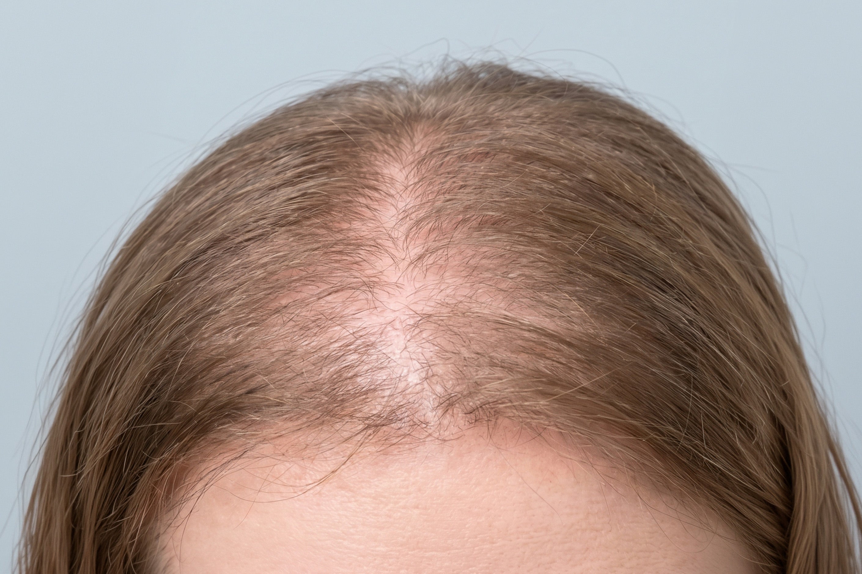 Hair roots and parting before using WAU ATAMA