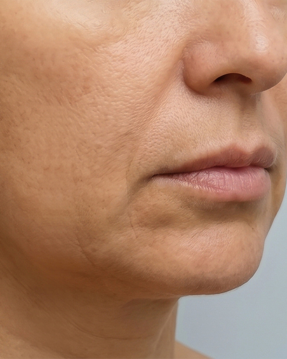 Facial contour before using WAU VIA GOLD